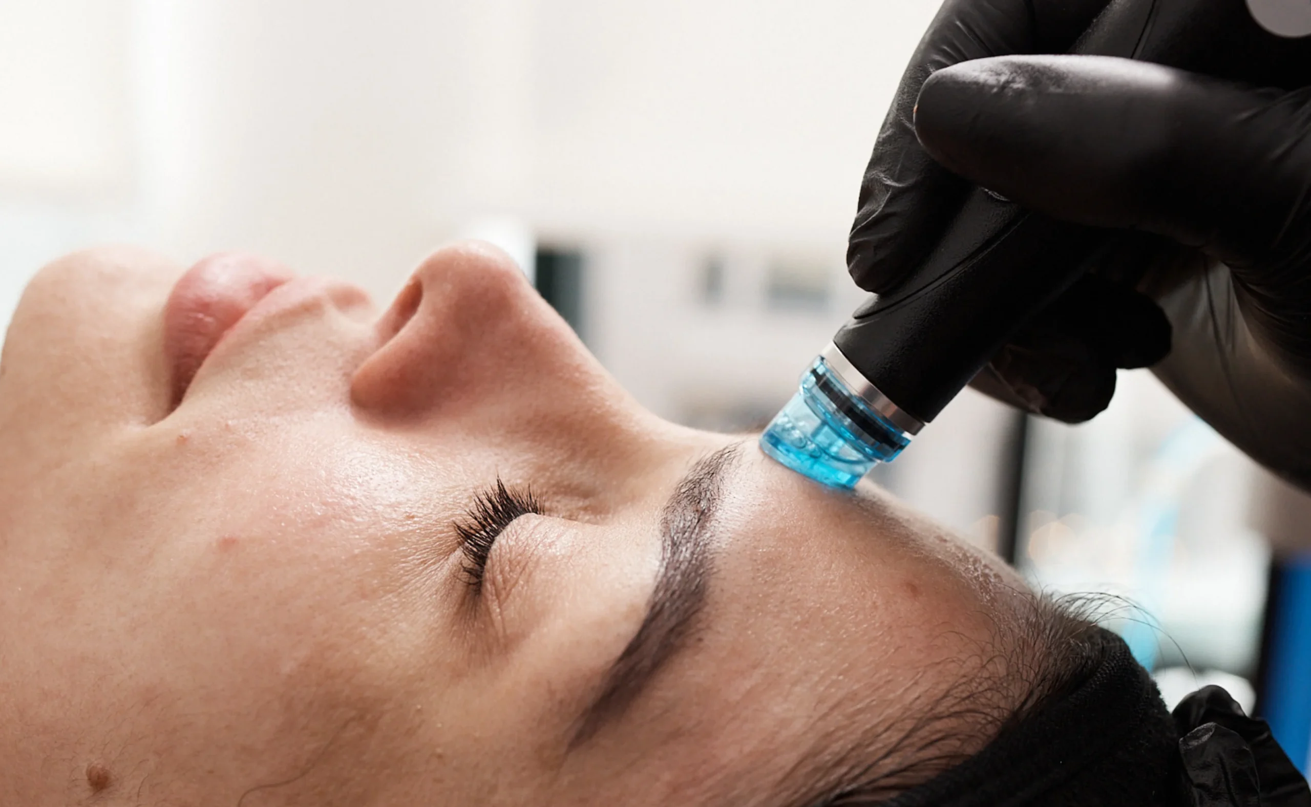 Radiant Face leke protokolü profesyonel cilt bakım uygulaması
